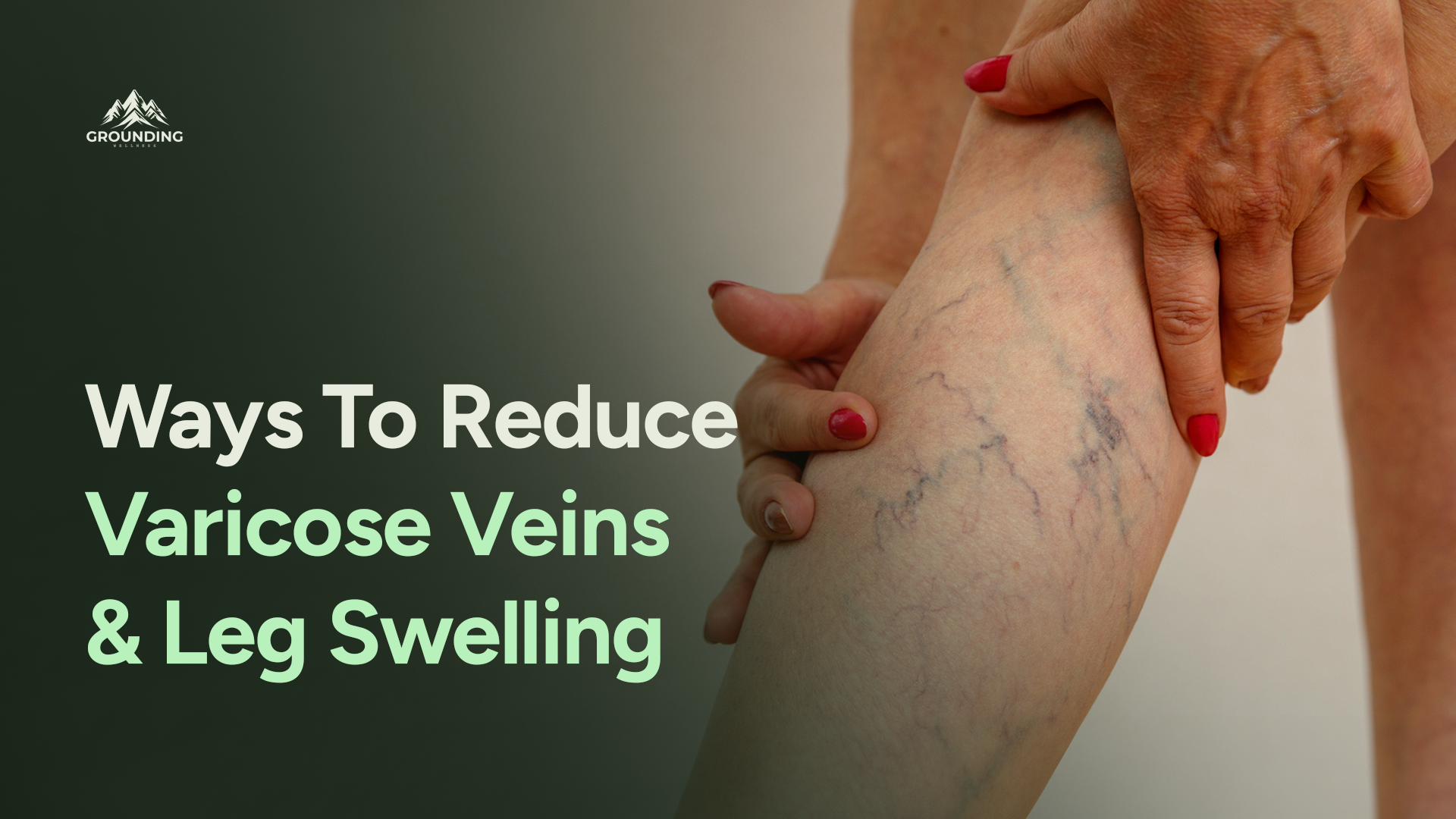 How To Reduce Varicose Veins and Relieve Leg Swelling?